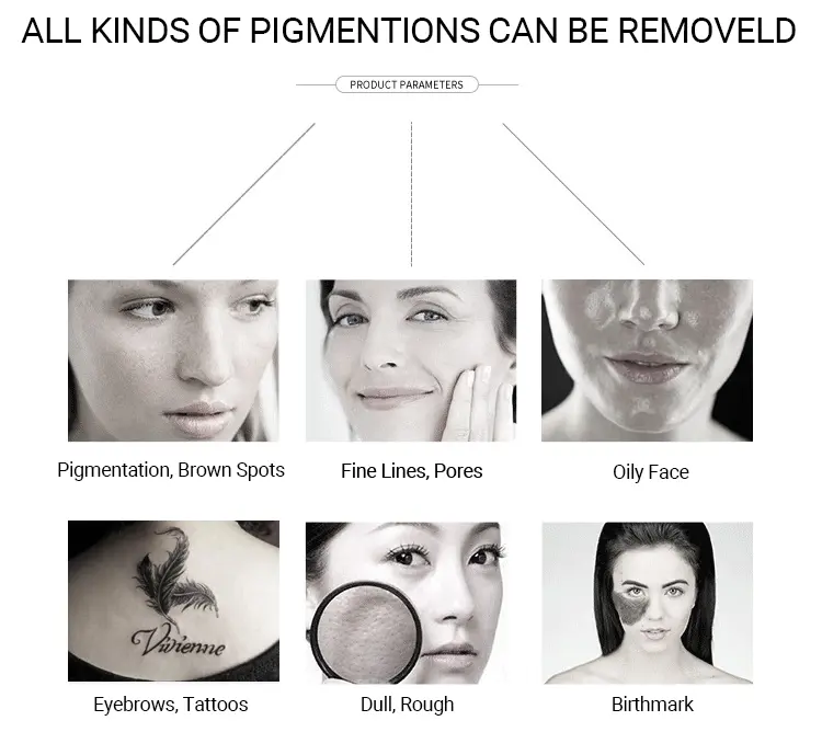 BENEFITS Picosecond laser tattoo removal