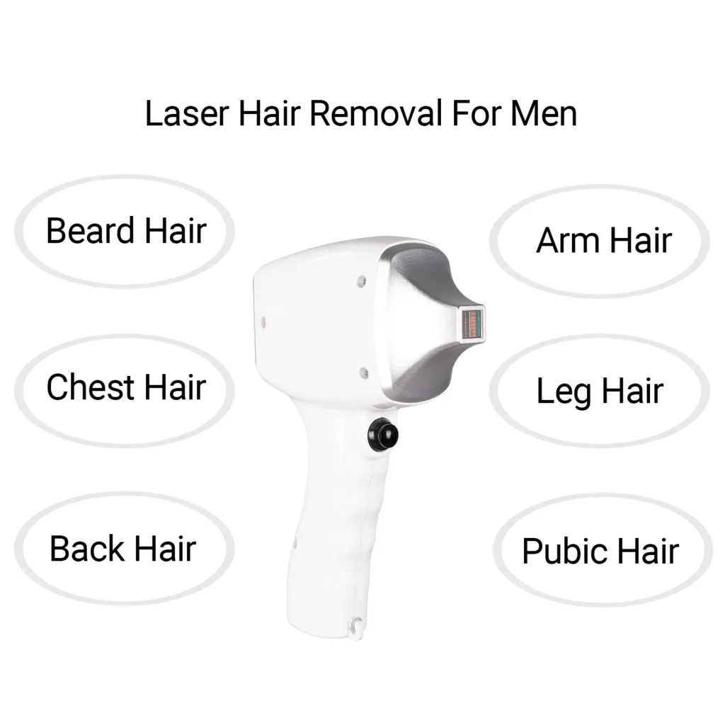 Diode laser hair removal for beard