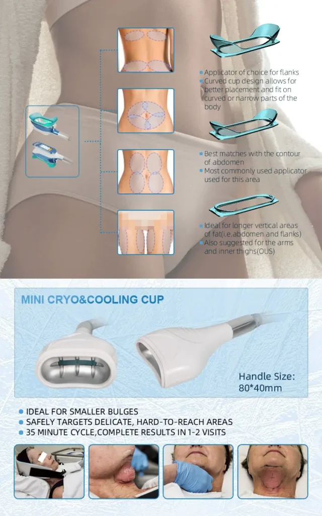 treatment body parts