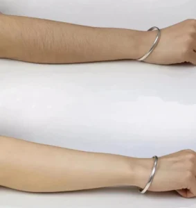 results Diode laser hair removal