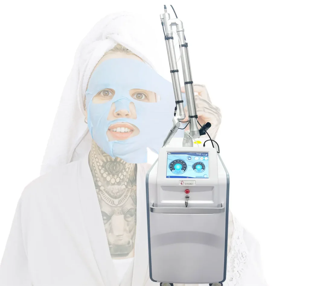 picosecond laser