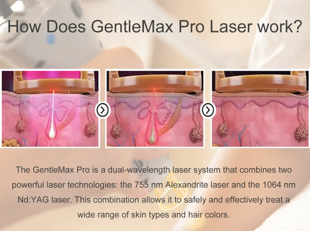 how does it work ,755nm 1064nm dual wavelength laser