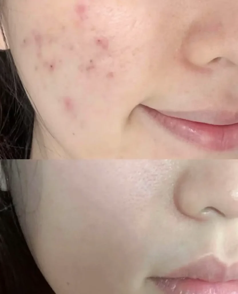 SKIN REJUVENATION