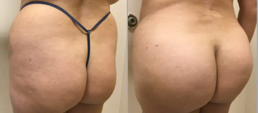 feedback