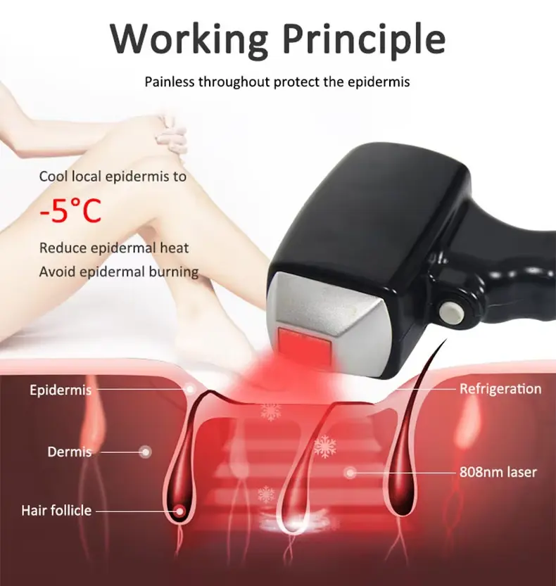 diode laser hair removal