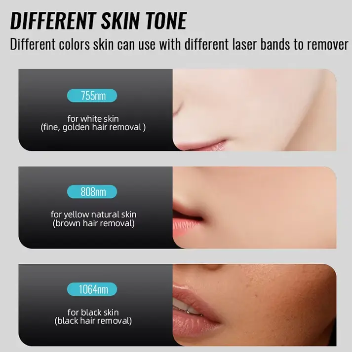 diode laser hair removal