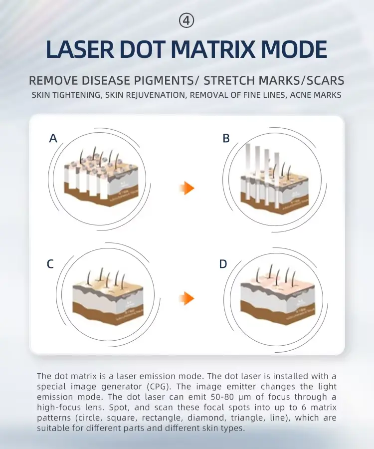 fractional co2 laser