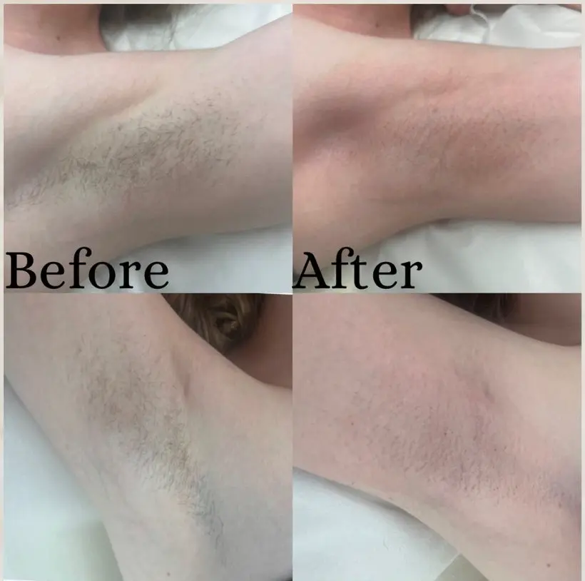 soprano before and after