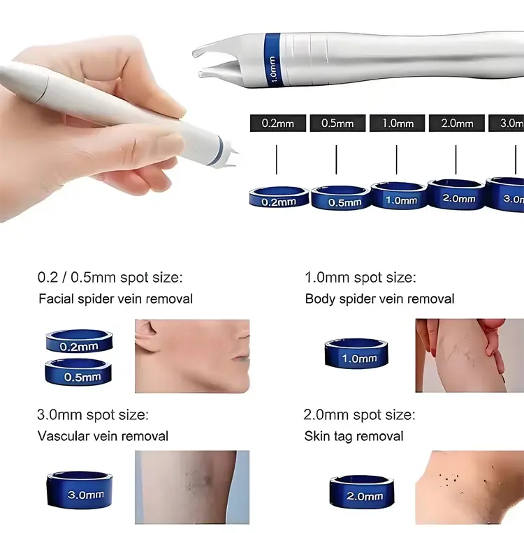 vascular-removal-980-2