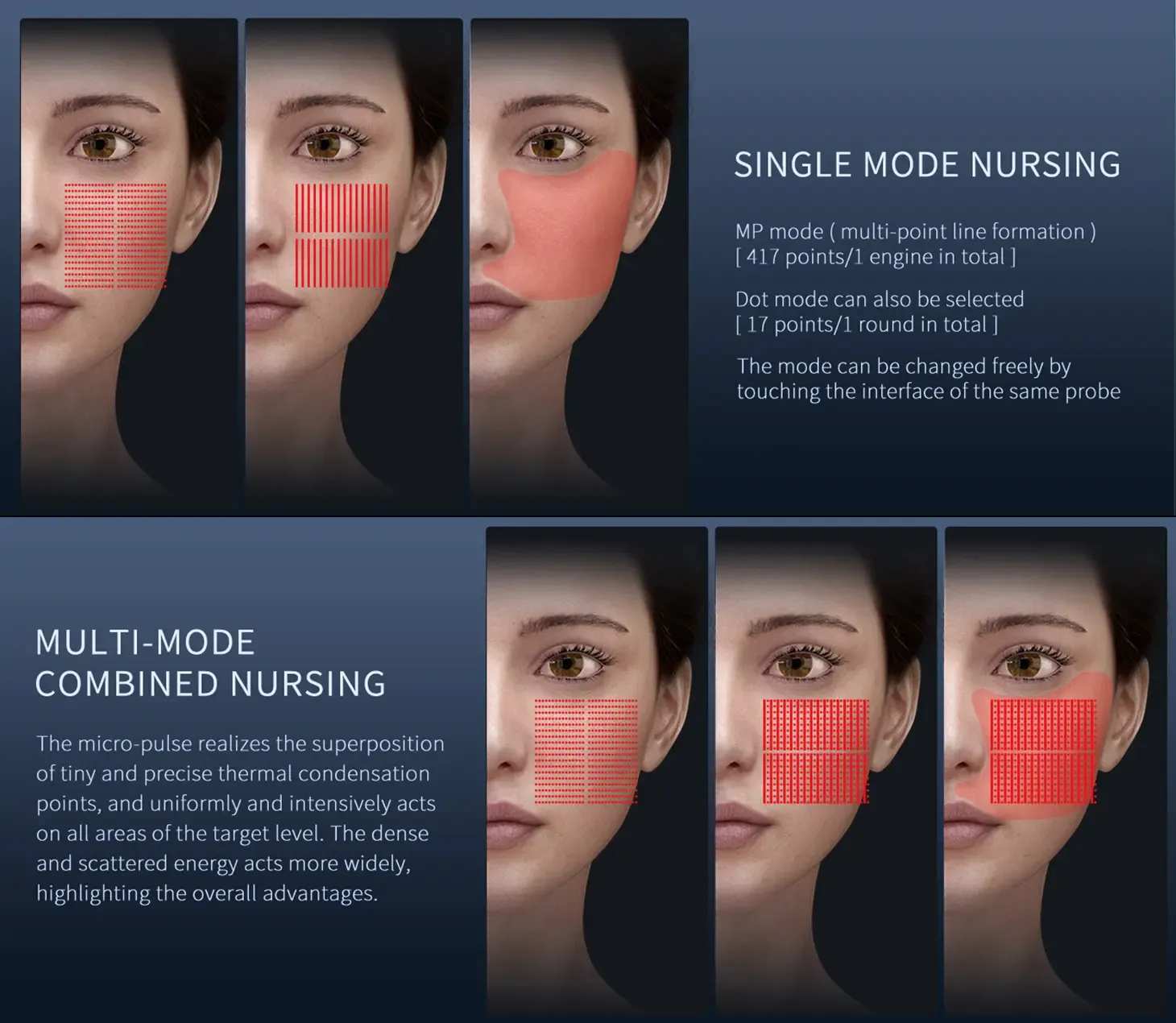 HIFU facial machine