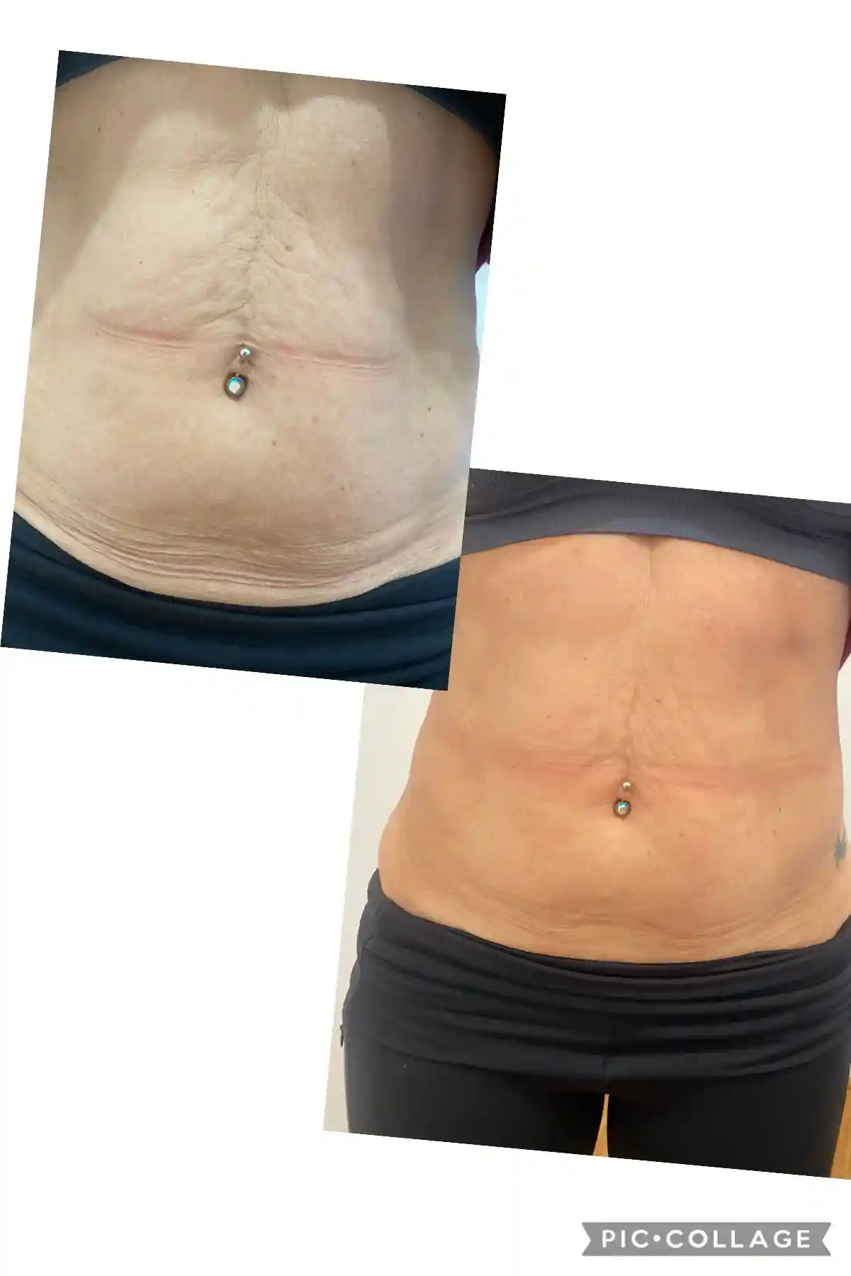 before and after