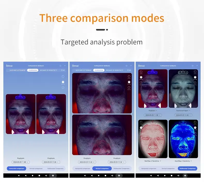 skin analyzer machine