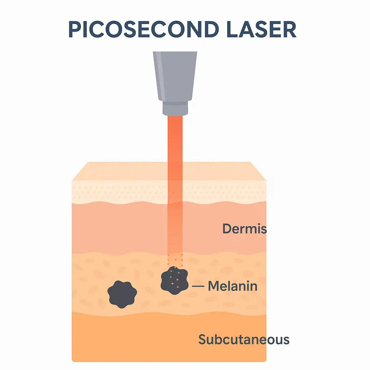 2 in 1 diode laser and picosecond laser