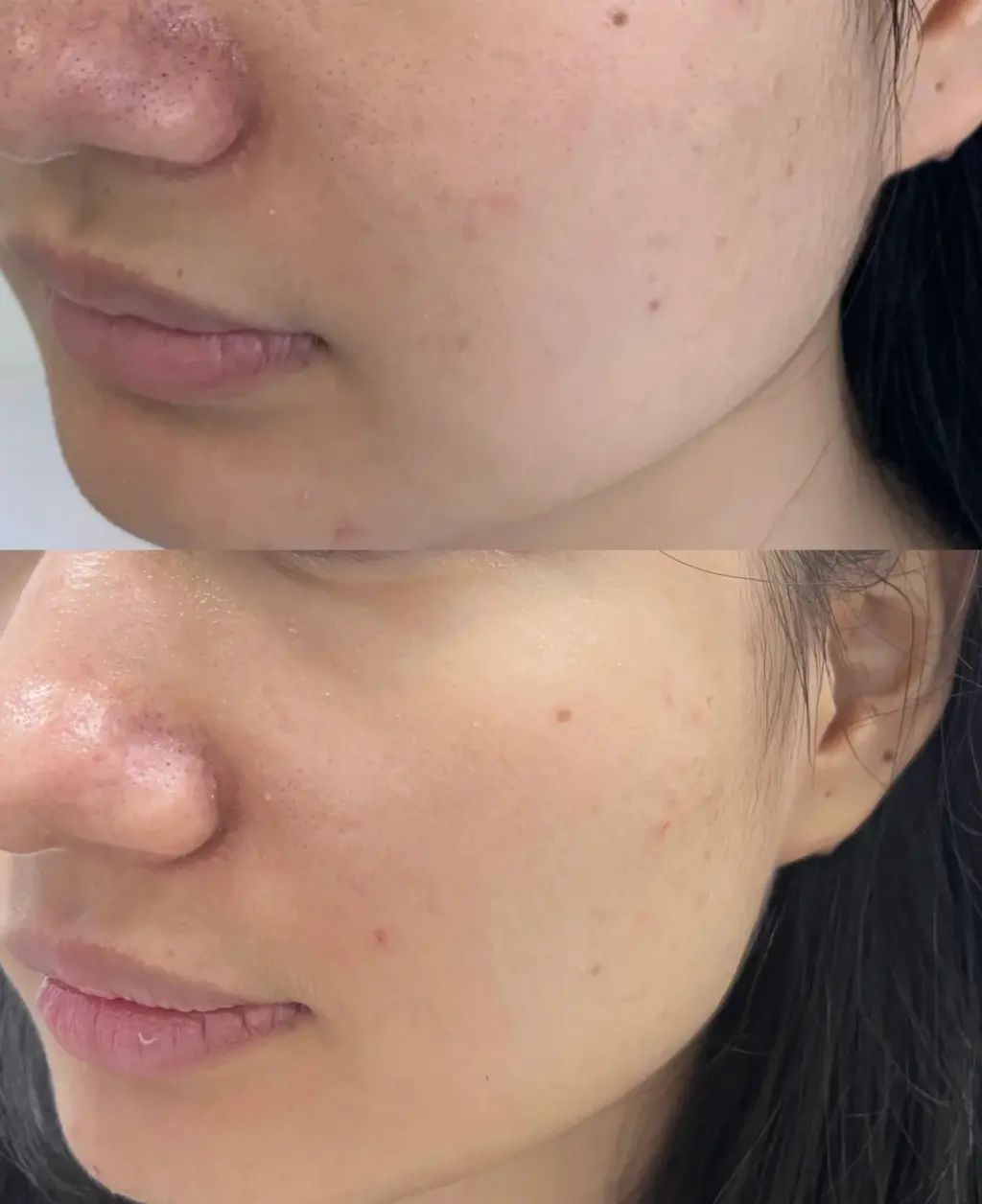before and after