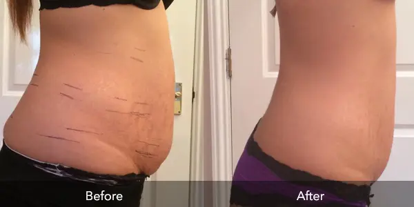 body slimming feedback