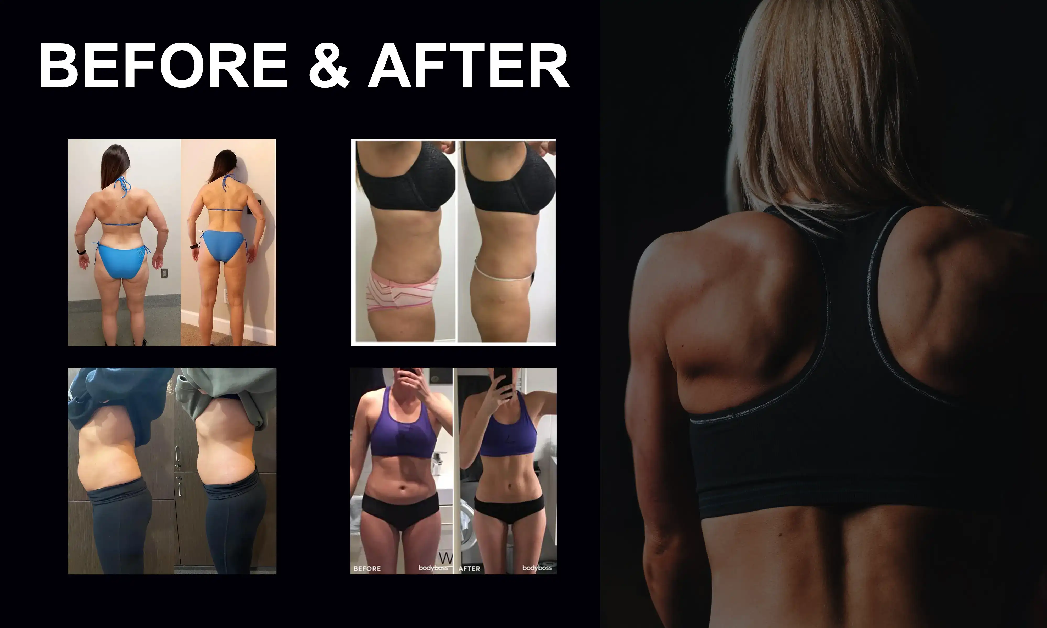 Emsculpt machine