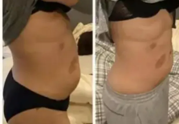 cavitation slimming review
