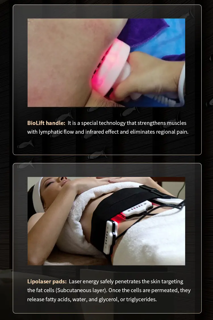 cavitation lipo laser machine