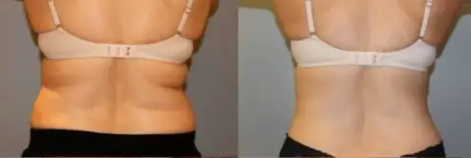 body slimming feedback